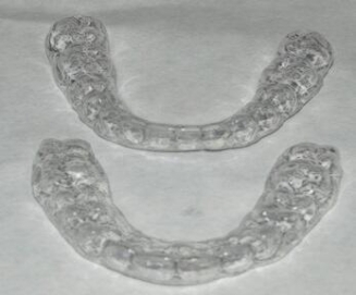 Ortodòncia invisible