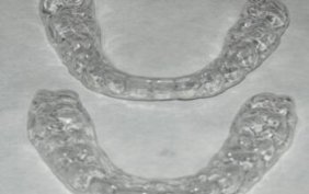 Invisible orthodontics